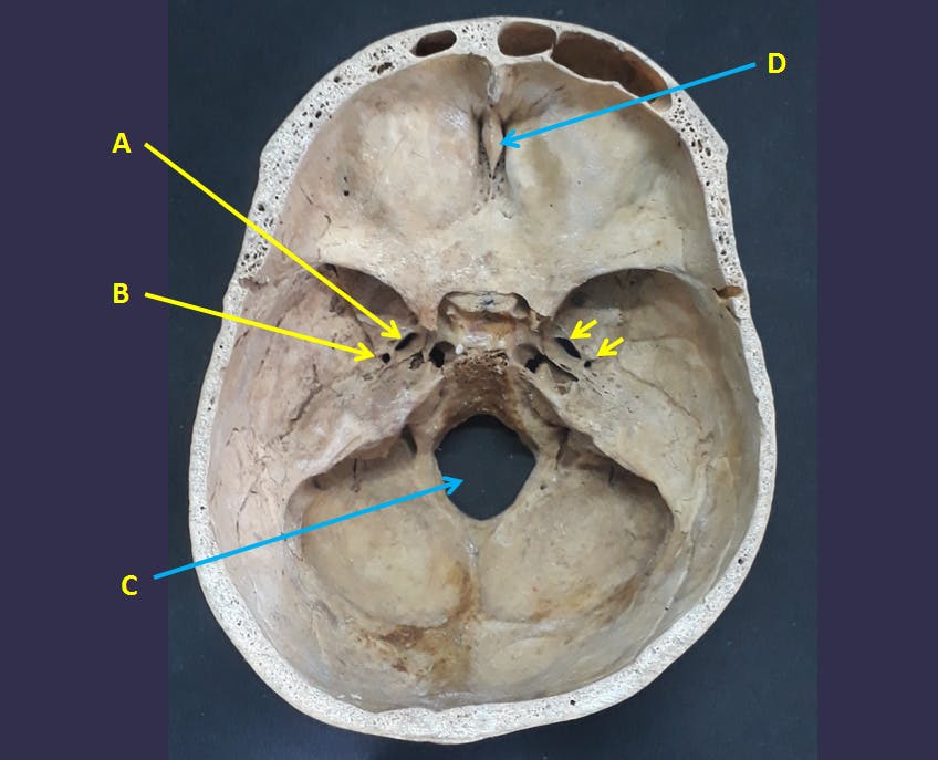 Skull