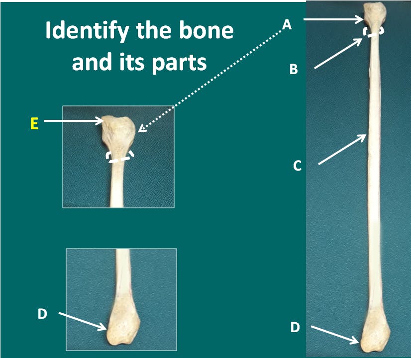 Fibula