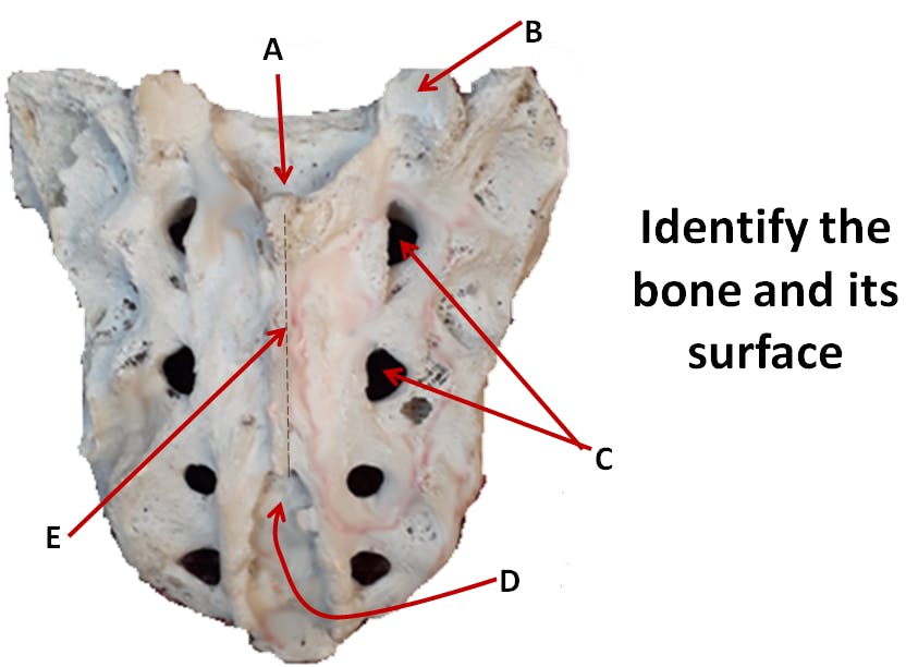 Sacrum and Articulated Pelvis