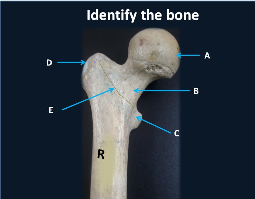 Femur