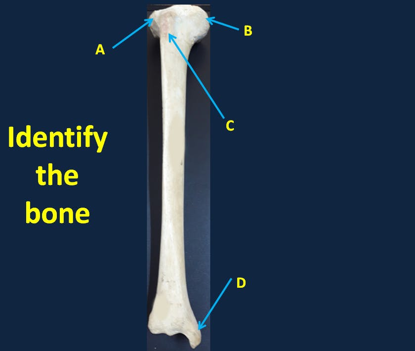 Tibia