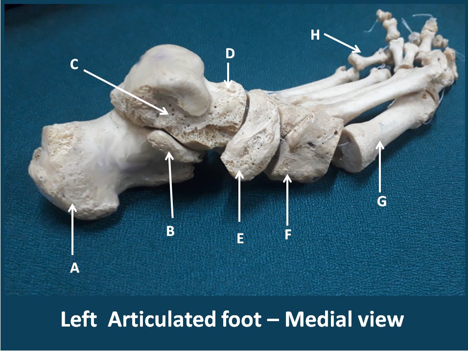 Articulated foot